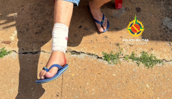 Pitbull ataca homem e mata cachorro no Paranoá, no DF 