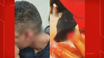 Homem morde seguranças de casa noturna no DF e arranca pedaços de orelha e dedo